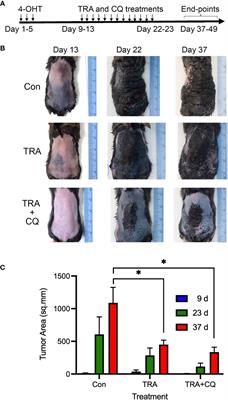 Co-Treatment of Chloroquine and Trametinib Inhibits Melanoma Cell Proliferation and Decreases Immune Cell Infiltration